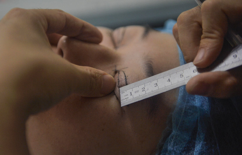 Doctors prep a female university graduate for eyelid surgery at a cosmetic-surgery hospital in Shenyang, Liaoning province, June 11, 2018. IC