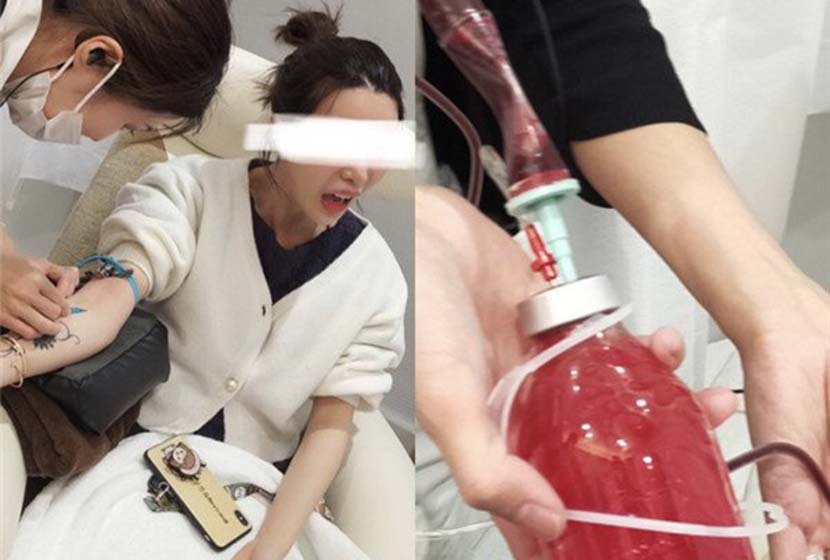 A Chinese web celebrity undergoes a ‘blood cleaning’ procedure in Japan. From @张沫凡MOMO on Weibo