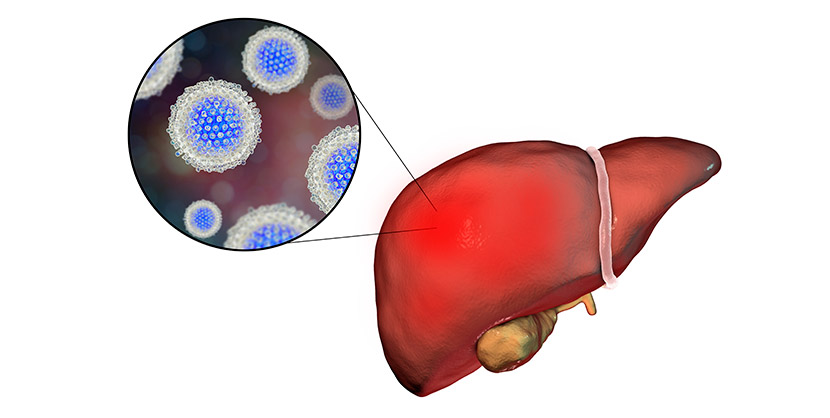 An illustration shows a hepatitis-infected liver and a close-up of the hepatitis C virus. Science Photo Library/VCG