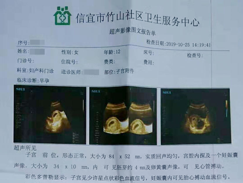 A medical document with ultrasound images confirming the 12-year-old victim’s pregnancy. Courtesy of her family