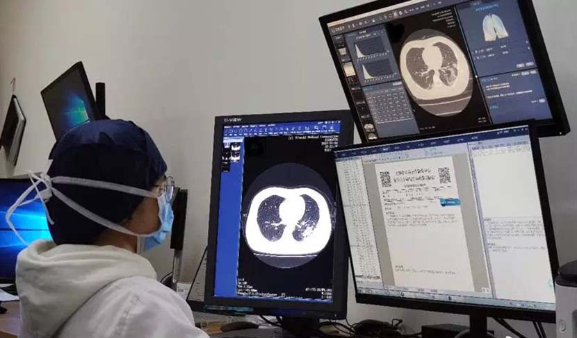 A medical worker uses an AI system to analyze a patient’s CT scan at the Shanghai Public Health Clinical Center, Feb. 6, 2020. From @知未科技 on Weibo