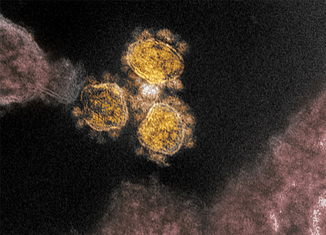 A transmission electron microscope image shows SARS-CoV-2 — the virus that causes COVID-19 — isolated from a patient in the United States. From NIAID-RML
