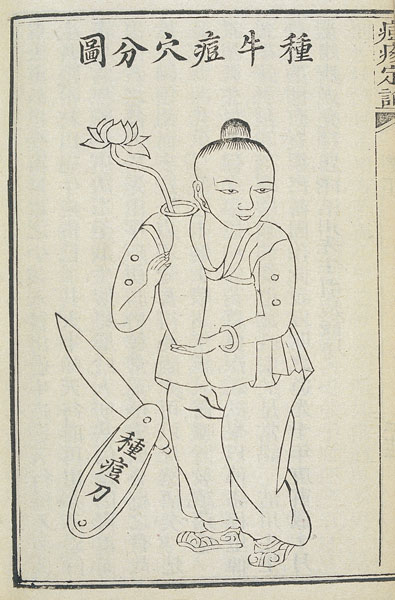 A Qing Dynasty diagram of a smallpox vaccination. Courtesy of Liu Xiaomeng
