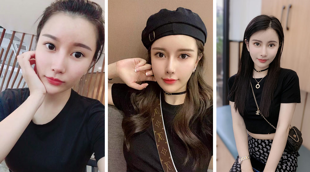 Gao poses for selfies, in images captured between 2015 and 2021. From left to right, the photos show her before her nose jobs, after her fourth procedure, and after she had the implants removed. Courtesy of Gao