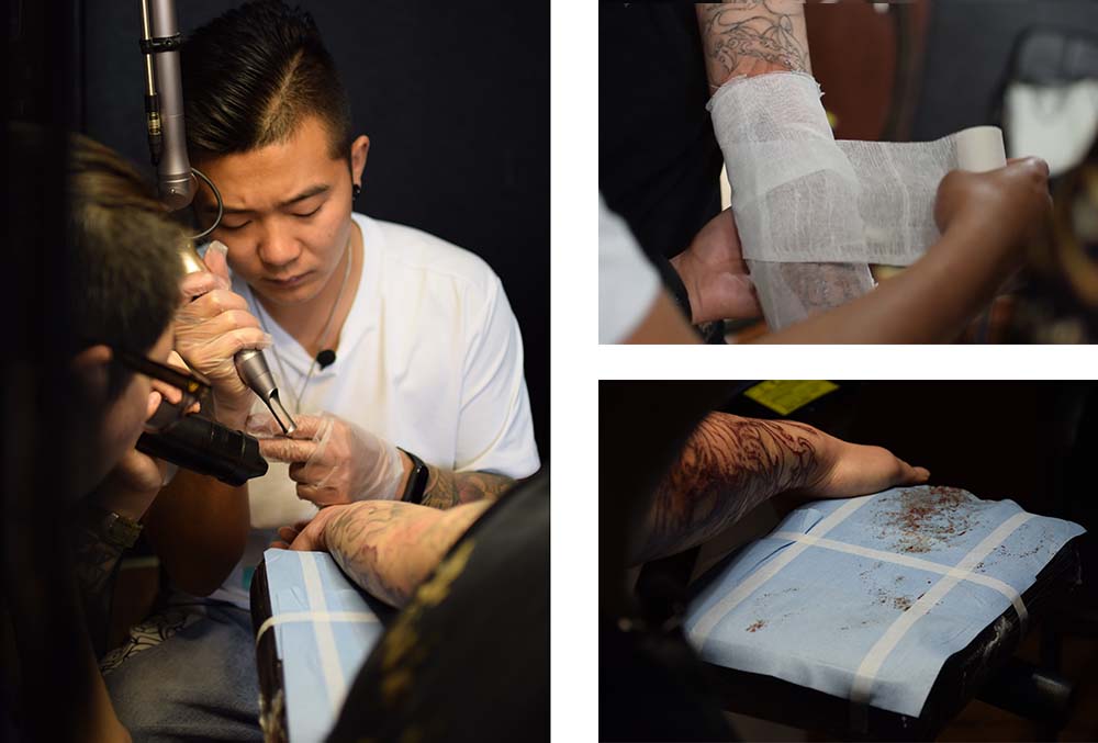 A tattoo artist removes a customer's tattoo at Bobo Tattoo Studio in Beijing, May 19, 2021. Wang Yiping and Zhang Mengyu for Sixth Tone