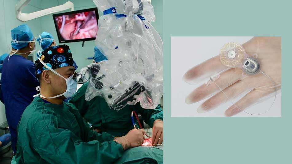 China Approves Nation’s First Brainstem Implant for Deafness