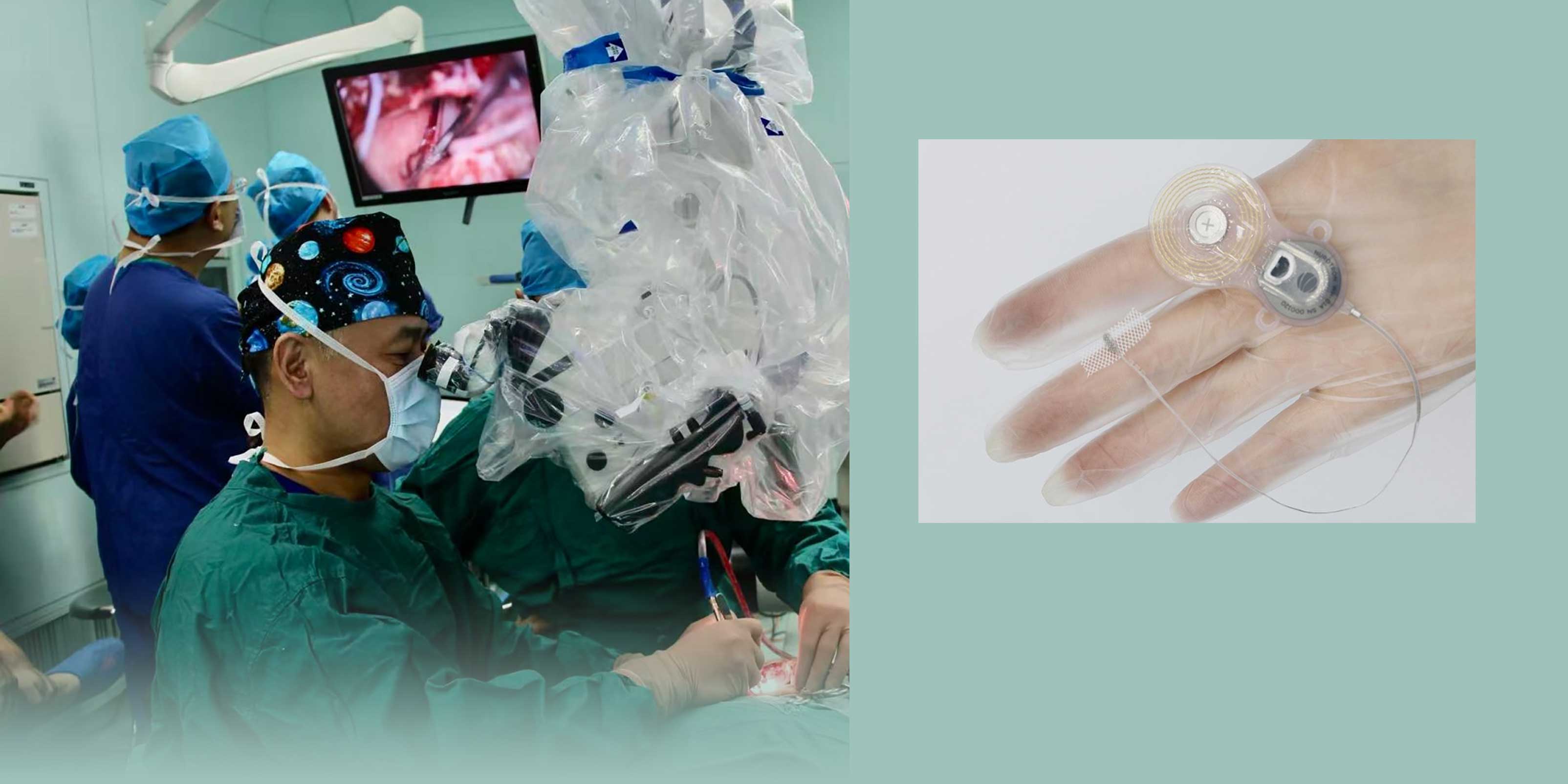 China Approves Nation’s First Brainstem Implant for Deafness