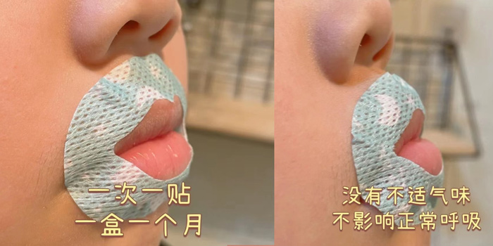 A Xiaohongshu post shares a parent's experience using mouth tape on their child. From Xiaohongshu