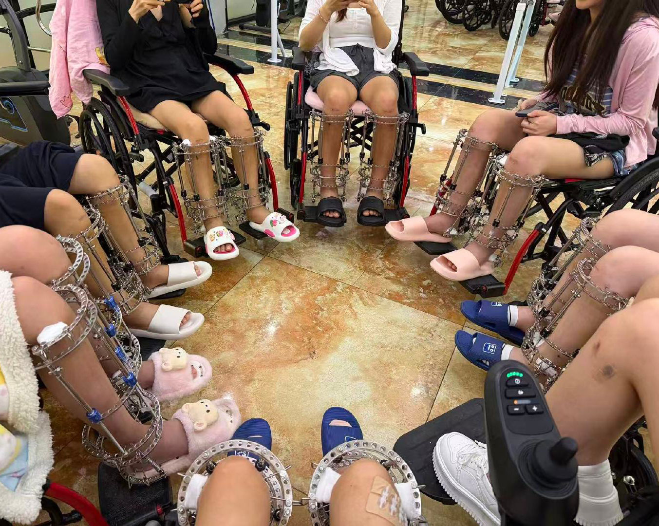 Phẫu thuật kéo dài chân chui ở Trung Quốc: Giấc mơ chiều cao biến thành cơn ác mộng vĩnh viễn